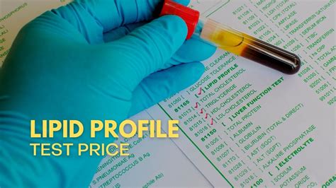 lipid profile test cost